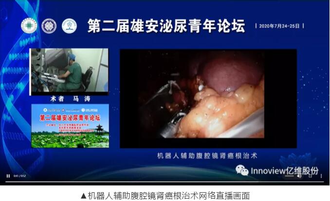 十大外围足彩排行榜远程示教系统完美助力雄安泌尿青年论坛手术演示